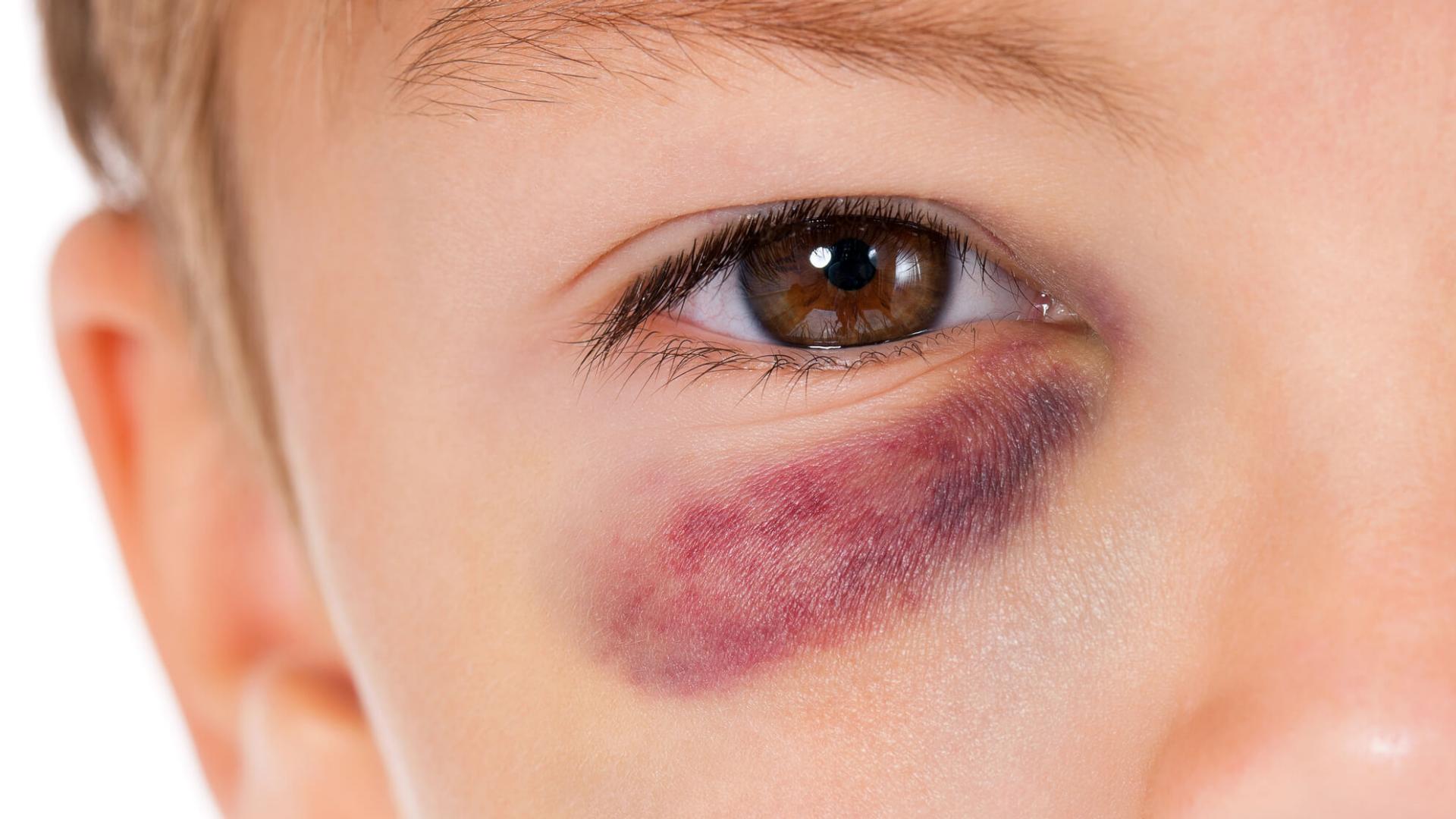In tema di lesioni personali, il c.d. postumo è un effetto ch...