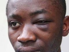 Pesta un ambulante per pregiudizio di superiorità razziale e ...