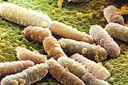 Escherichia coli 3 Luglio 2011    Situazione sotto controllo